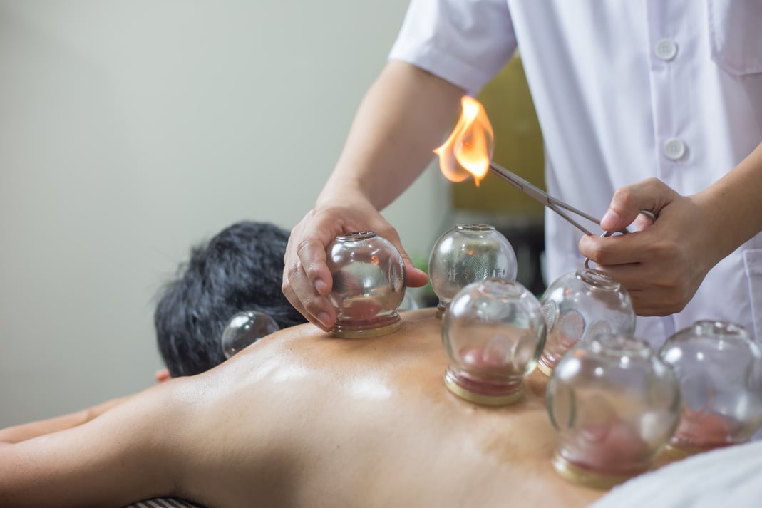 Traditional Chinese Medicine Treatment - Acupuncture